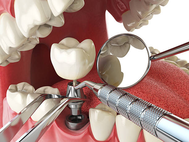 Best Cosmetic Emergency Dentistry in Harrisonville, MO
